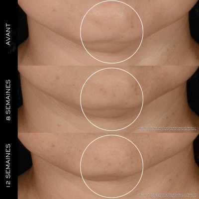 Lancome Rénergie H.P.N. 300-Peptide Crème Anti-Âge Haute-Performance – Image 4